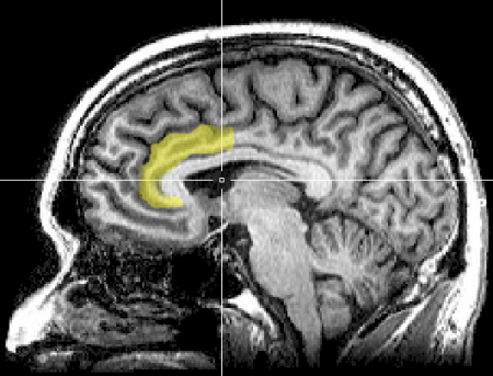 MRI_anterior_cingulate.thumb.png.78f19c8